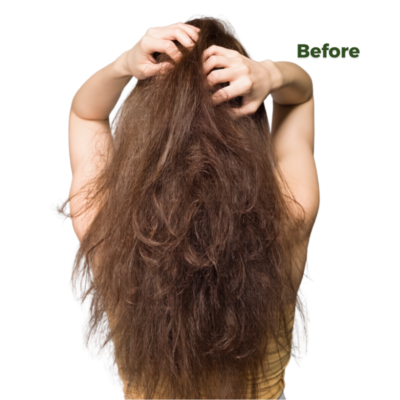 Person with long, tangled hair on a white background with 'Before' text.