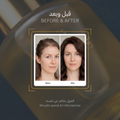 Hair Thickening & Revitalizing Set thumbnail 6
